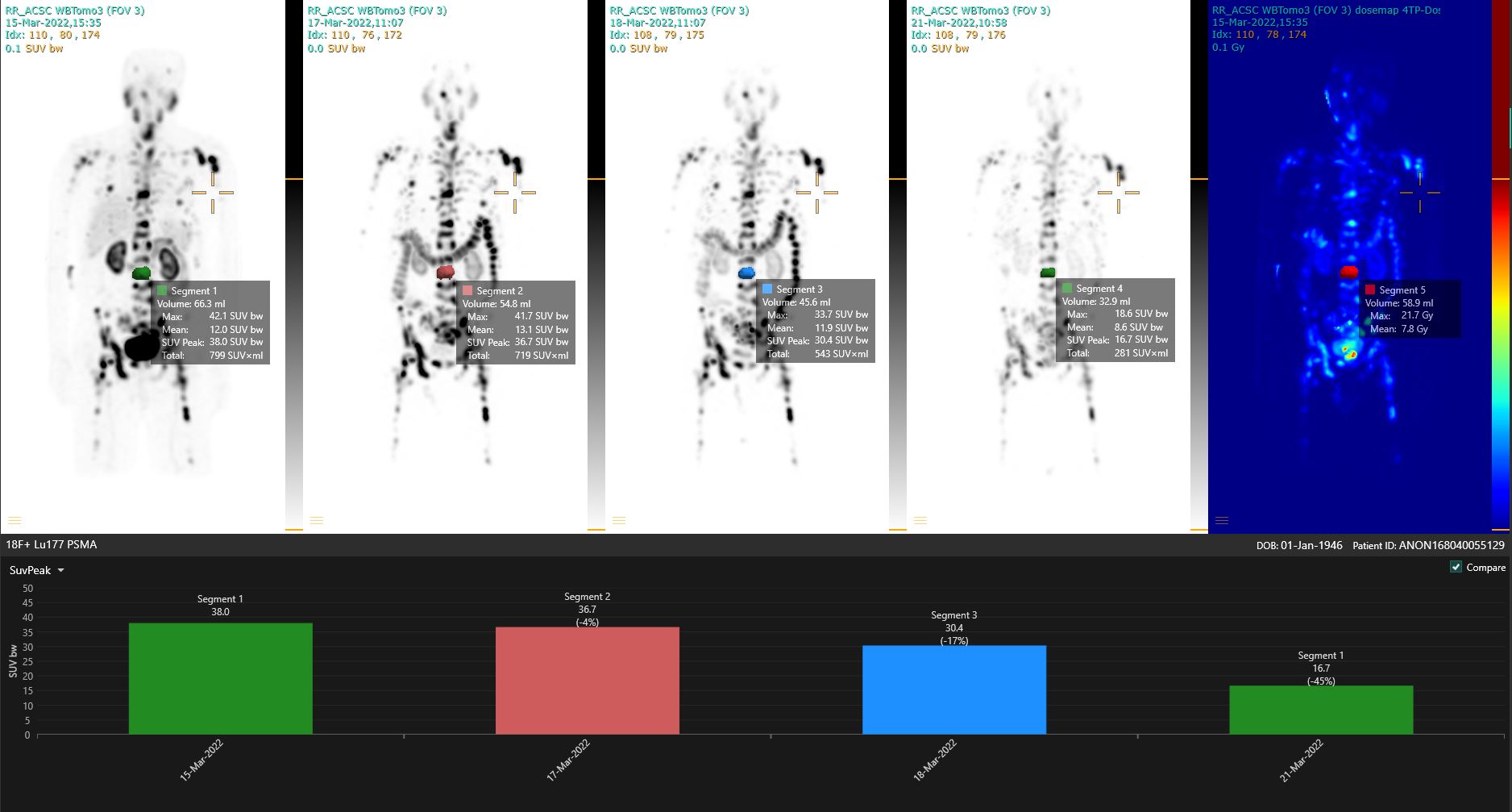 Statistics dashboard Advanced analysis tools, including Column charts for serial imaging and Dose Volume Histograms