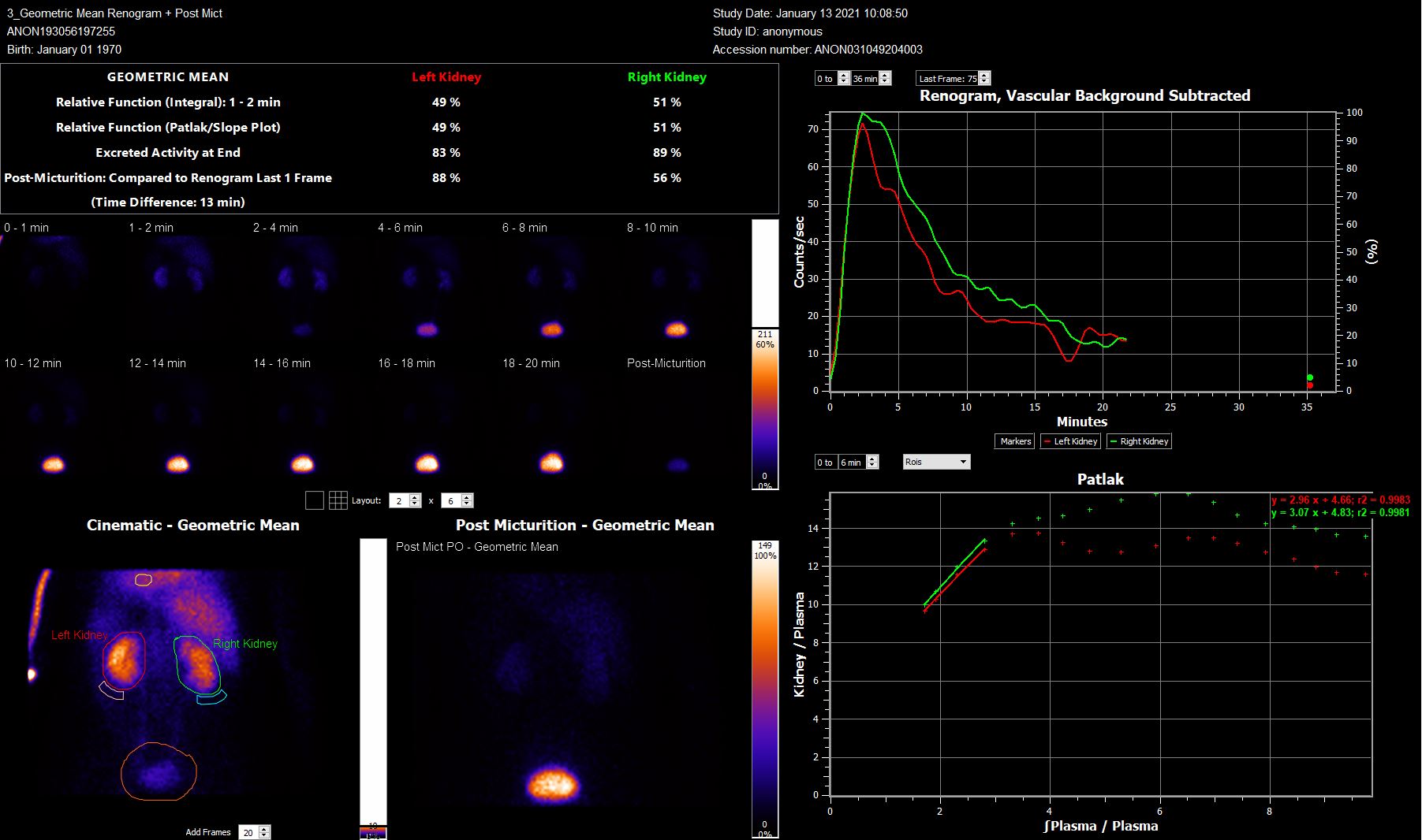 Renogram plus post-micturition static analysis with Patlak fit validation