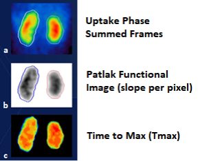 Patlak Nephrology Kidney images in molecular imaging
