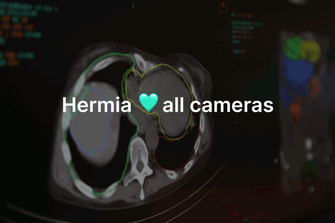 "Hermia loves all cameras" statement above the Hermia workstation