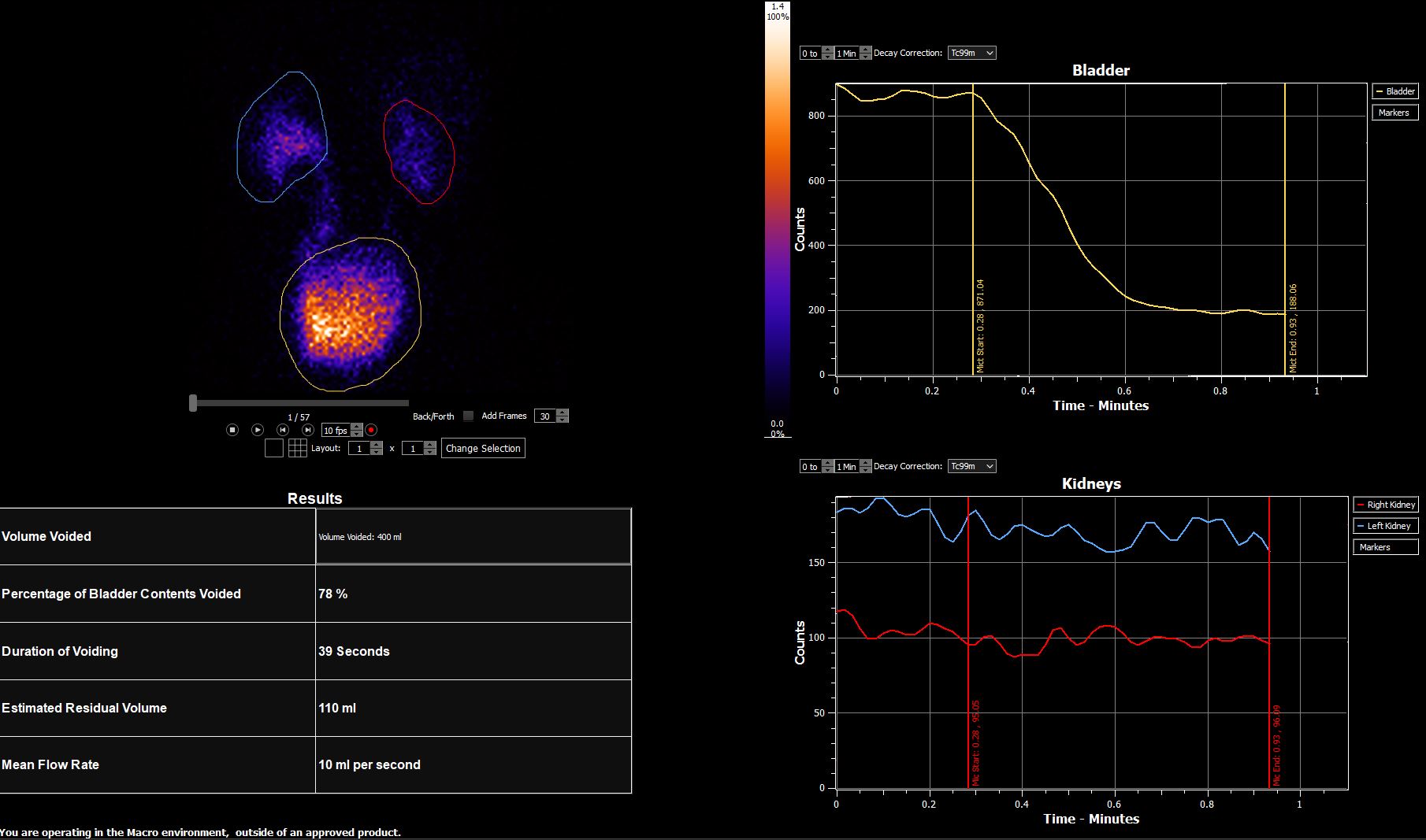 Indirect cystogram analysis within the HERMIA custom macro environment