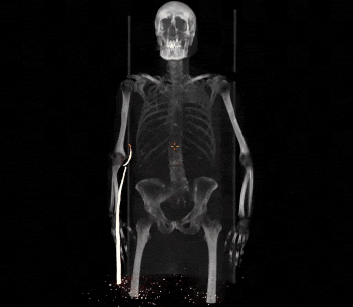Whole-Body PET/CT provided by Inselspital Bern, Switzerland